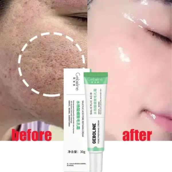 Salicylic Acid Pore Shrinking Cream Quick Elimination Large Pores Remove Blackehead Tighten Face Smooth Skin Korean Care Product - Image 2