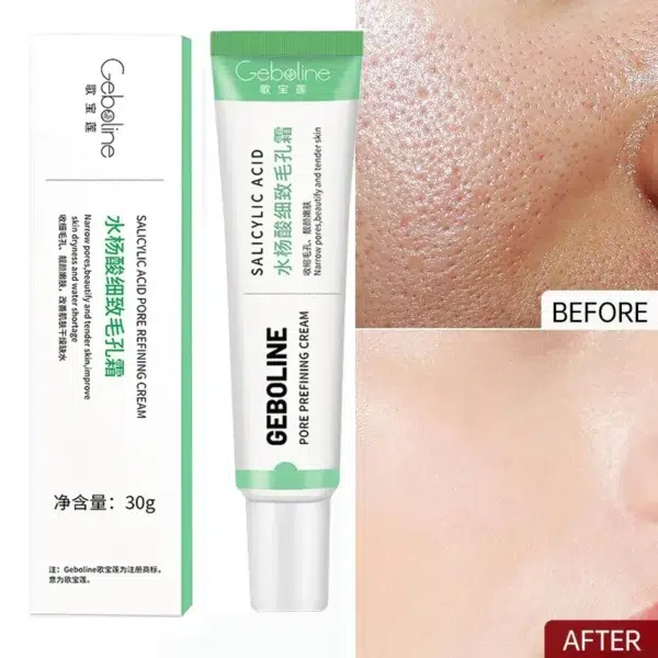 Salicylic Acid Pore Shrinking Cream Quick Elimination Large Pores Remove Blackehead Tighten Face Smooth Skin Korean Care Product - Image 5