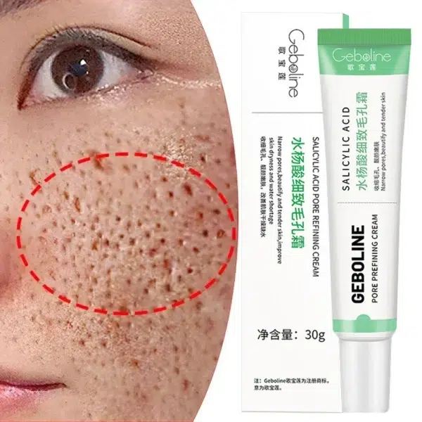 Salicylic Acid Pore Shrinking Cream Quick Elimination Large Pores Remove Blackehead Tighten Face Smooth Skin Korean Care Product - Image 6